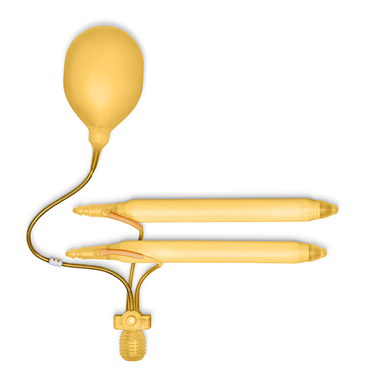 Three-Piece Penile Implant (AMS)
